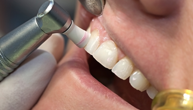 Konya Diş Eti Hastalıkları & Tedavisi - Periodontoloji