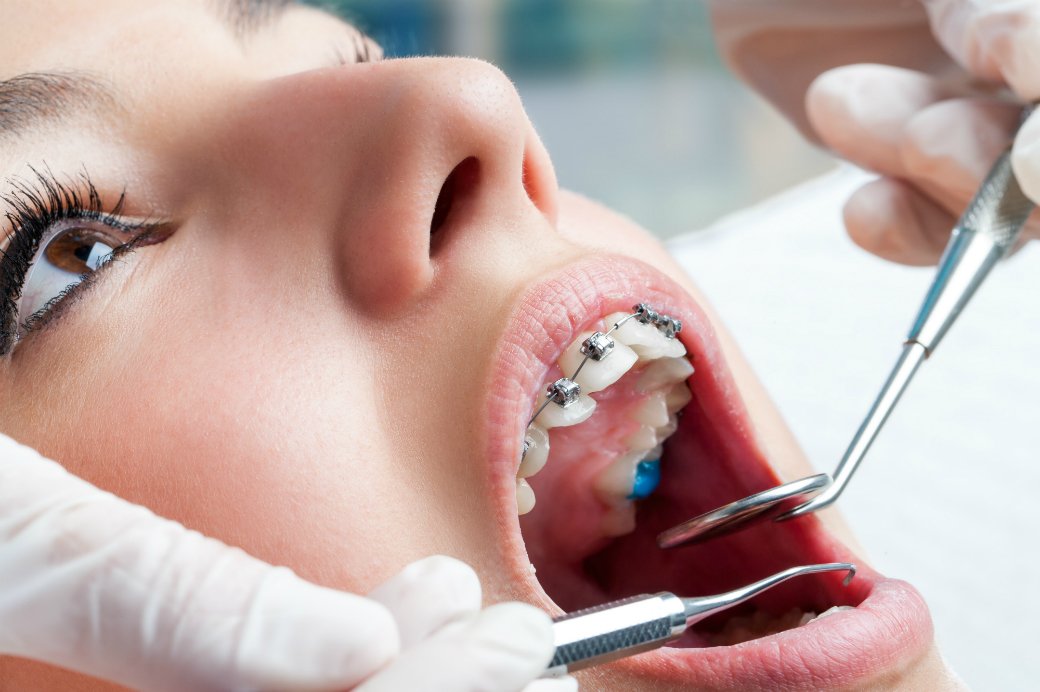 Ortodontik Tedavi Neden Yapılır